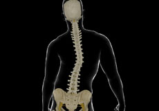 Adolescent Idiopathic Scoliosis