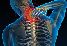 Failed Back Surgery Syndrome