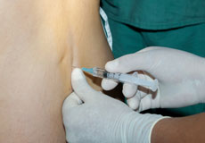 In-Office Lumbar Injections