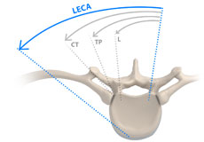 Lateral Extracavitary Approach Surgery