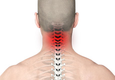 Neck Pain