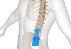 Oblique Lumbar Interbody Fusion (OLIF)