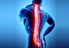 Spondyloarthropathies